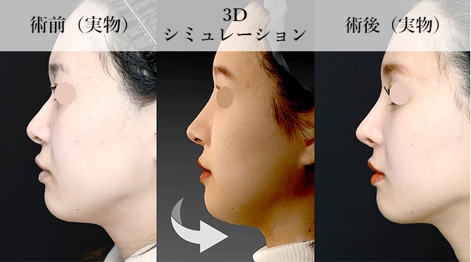 3Dシミュレーションでお客様と完成イメージを共有(無料)